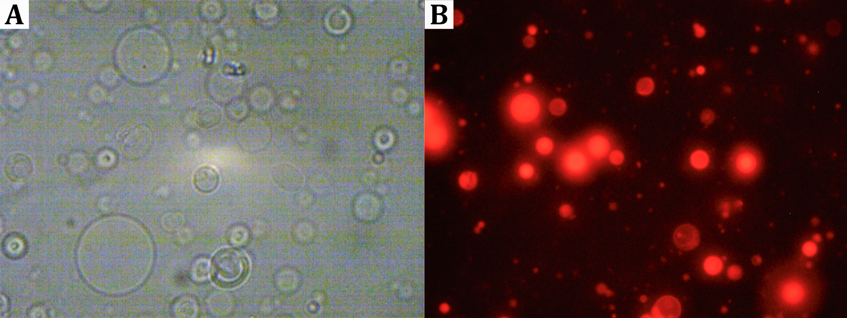 Durchlichtmikroskopische Aufnahmen von Vesikeln. (B) Fluoreszenzmikroskopische Aufnahmen Texas Red-markierter Vesikel.